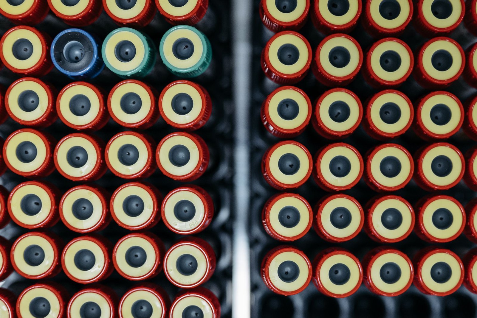 Array of capped laboratory test tubes in a clinical setting.